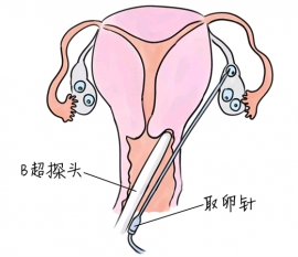 幼儿学画画，南通捐卵宝宝学画画，学画画的好处，如何学画画