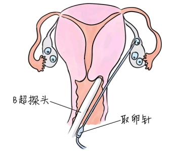 幼儿学画画，南通捐卵宝宝学画画，学画画的好处，如何学画画